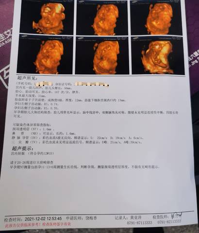 journal_insert_pic_1677047426