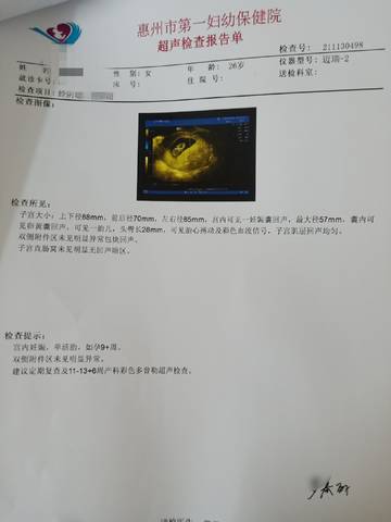 journal_insert_pic_1674464516