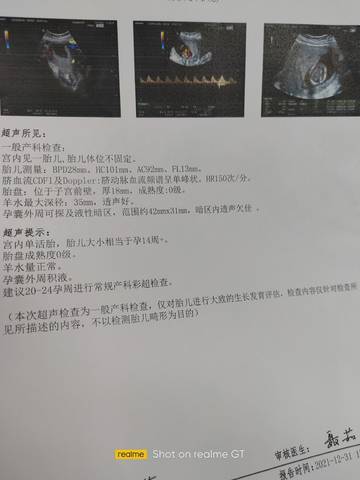 journal_insert_pic_1689647079