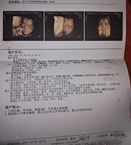 journal_insert_pic_1685346843