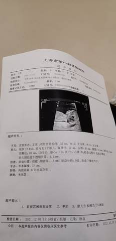 journal_insert_pic_1675923492