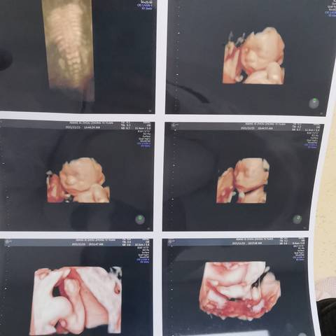 journal_insert_pic_1682389789