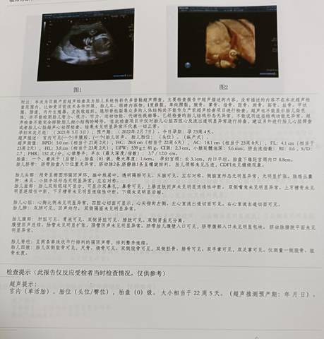 journal_insert_pic_1676821176
