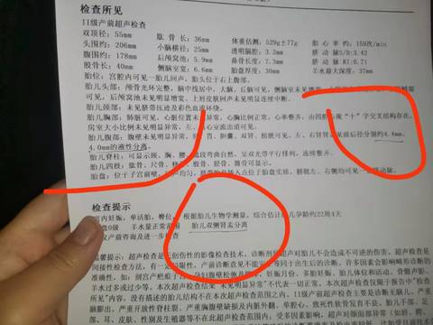 journal_insert_pic_1679831003