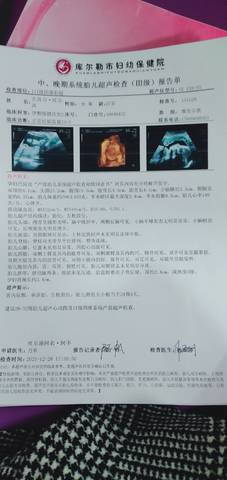 journal_insert_pic_1687890907