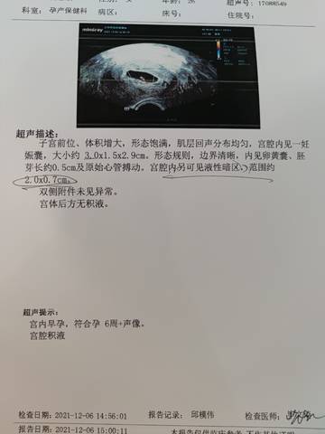 journal_insert_pic_1674882874