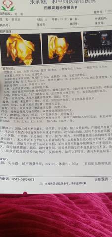 journal_insert_pic_1676343707