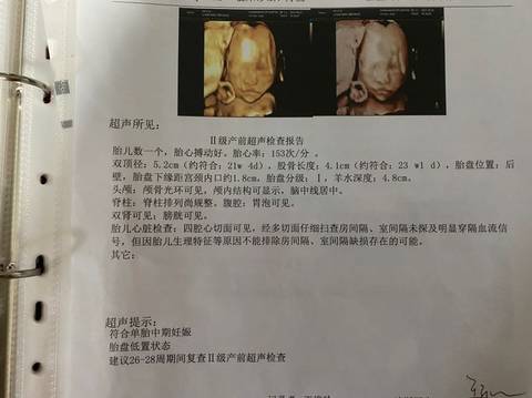 journal_insert_pic_1674135658