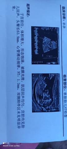 journal_insert_pic_1681335531