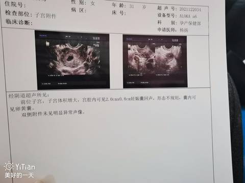 journal_insert_pic_1683038637