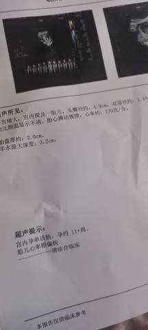 journal_insert_pic_1676246290