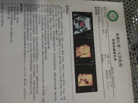 journal_insert_pic_1675304461