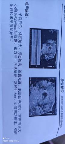 journal_insert_pic_1681335528