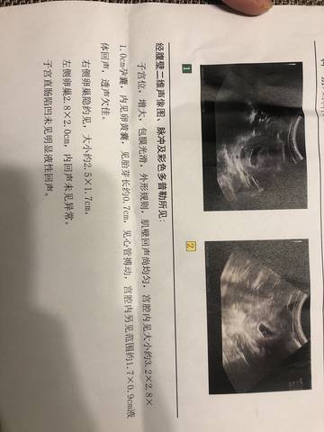 journal_insert_pic_1681757352