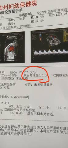 journal_insert_pic_1685781428