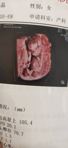 journal_insert_pic_1677457218