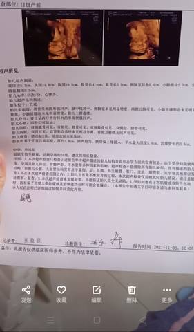 journal_insert_pic_1688951045