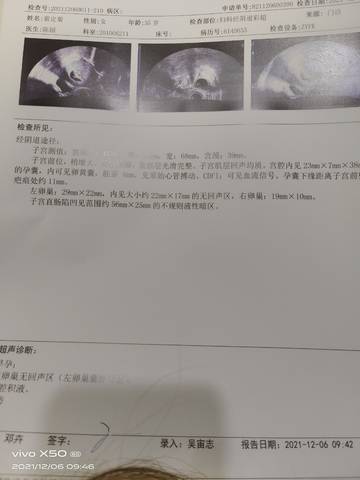 journal_insert_pic_1675213395