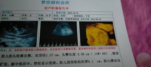 journal_insert_pic_1683854000