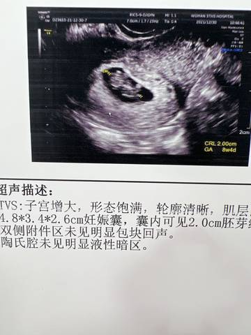 journal_insert_pic_1688823173