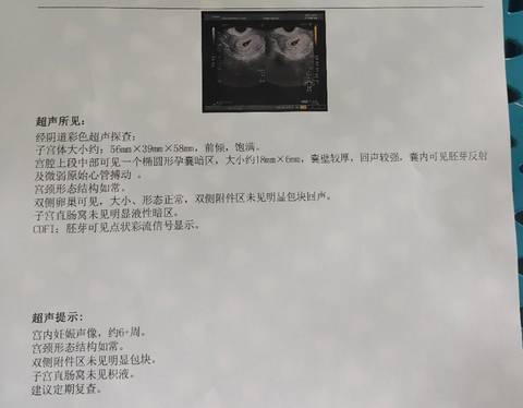 journal_insert_pic_1689513440