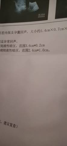 journal_insert_pic_1684852190