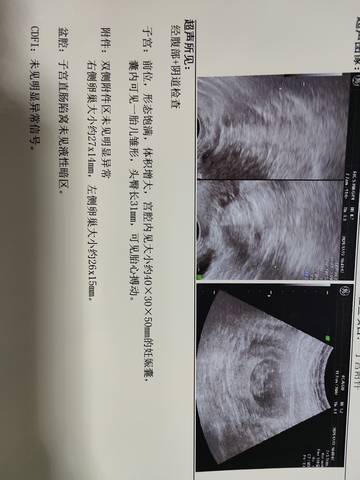 journal_insert_pic_1689310816