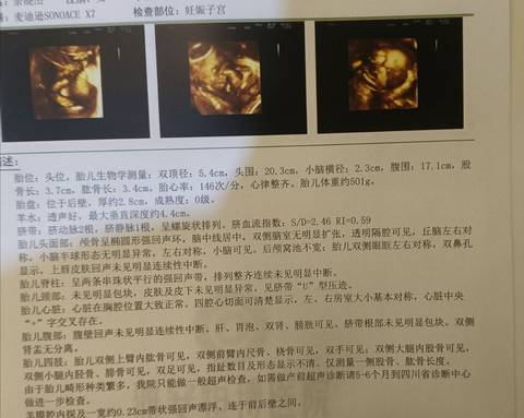 journal_insert_pic_1689485056