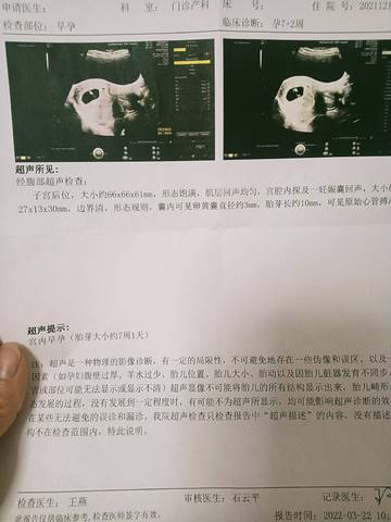 journal_insert_pic_1741174796