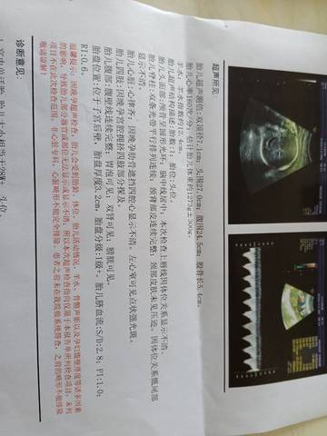 journal_insert_pic_1686479627