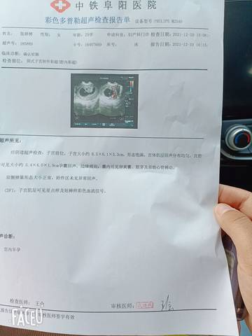 journal_insert_pic_1677325088