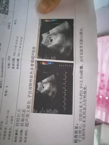 journal_insert_pic_1674714300