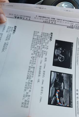 journal_insert_pic_1685011087