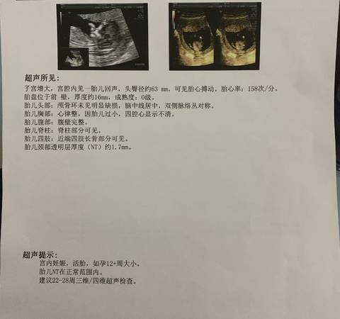 journal_insert_pic_1689348321