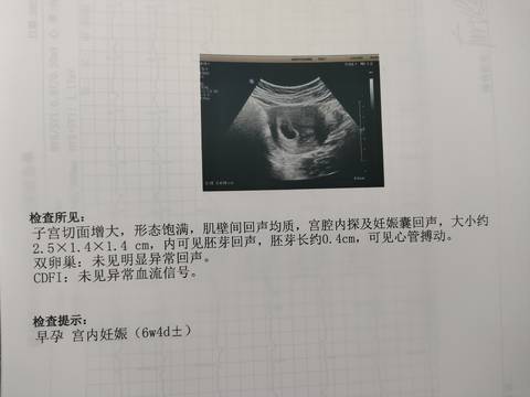 journal_insert_pic_1673447021