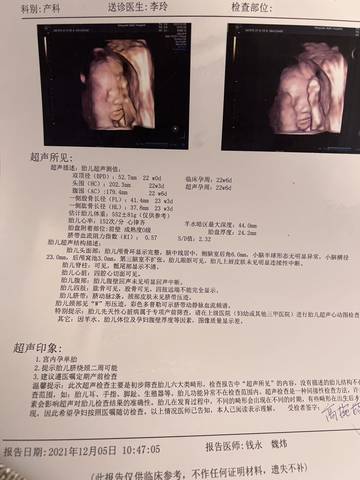 journal_insert_pic_1674138809