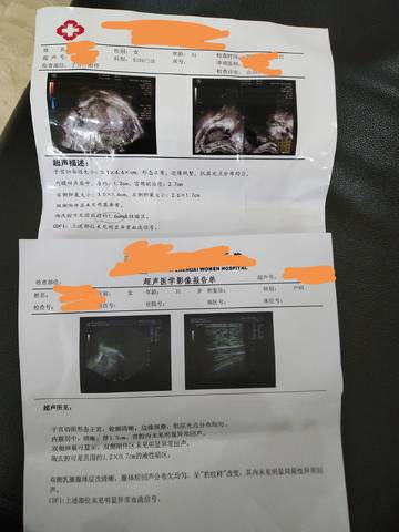journal_insert_pic_1678220275