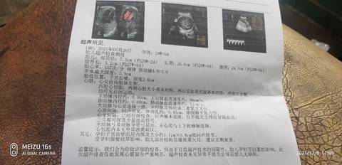 journal_insert_pic_1676048209
