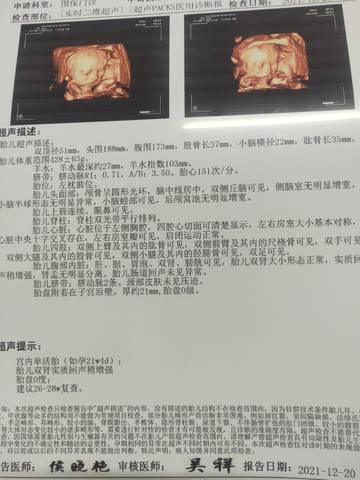 journal_insert_pic_1683227923