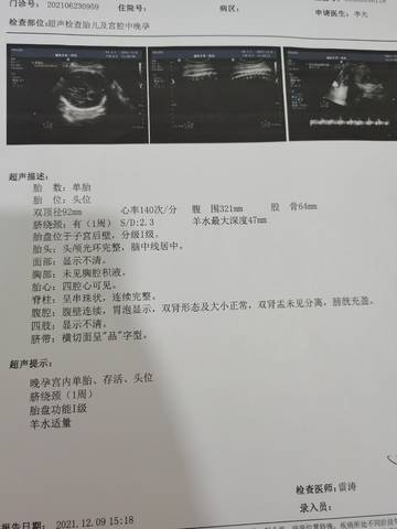 journal_insert_pic_1676896192