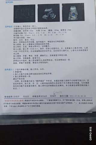 journal_insert_pic_1686300362