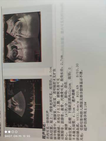 journal_insert_pic_1683017554