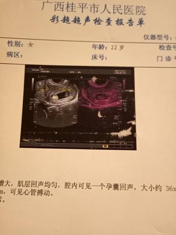 journal_insert_pic_1678111661