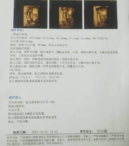 journal_insert_pic_1683703126