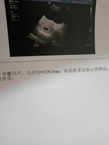journal_insert_pic_1686137599