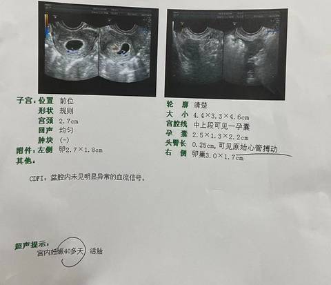 journal_insert_pic_1690589664