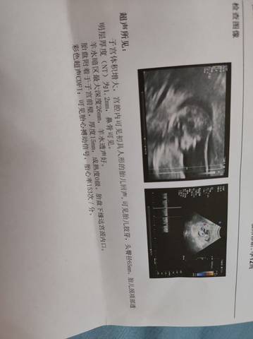 journal_insert_pic_1681794086