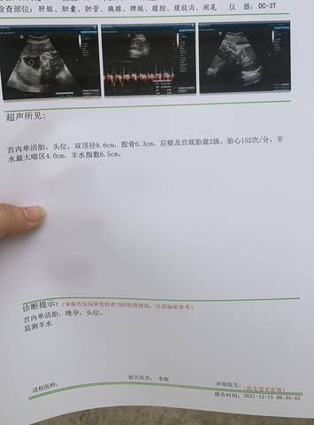 journal_insert_pic_1680989639