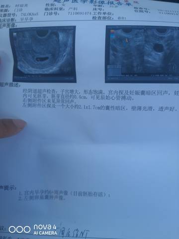 journal_insert_pic_1673503291
