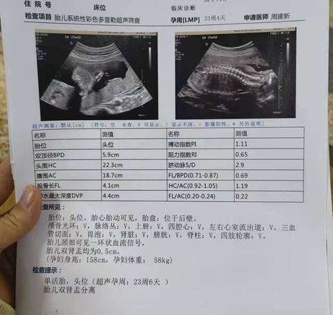 journal_insert_pic_1719378007